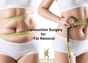 Liposuction Surgery for Fat Reduction